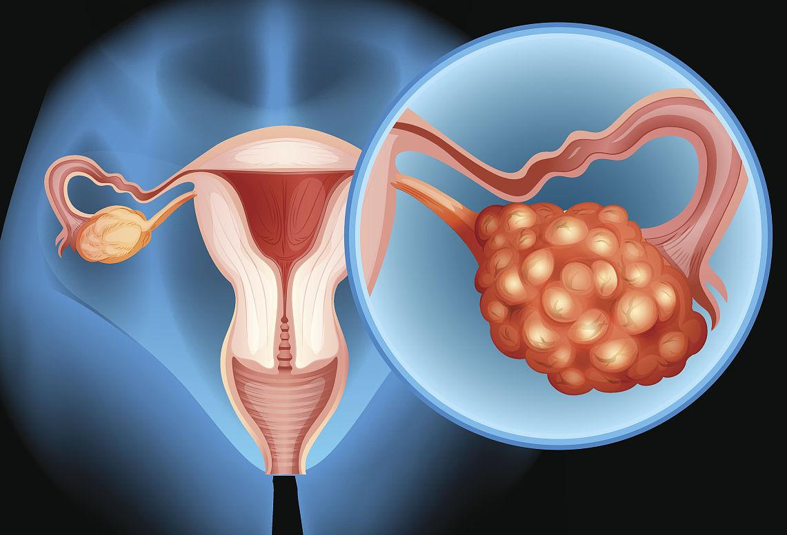 试管优胚是指什么,如何调理卵巢早衰助孕？